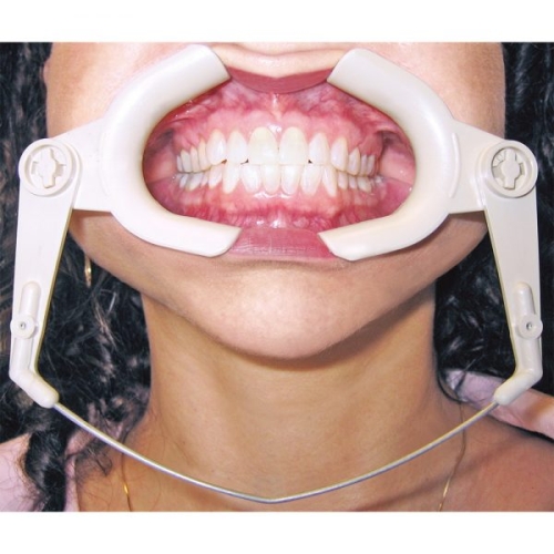 Cheek Retractor High Heat 