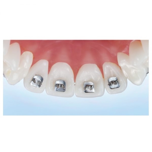 Tongue Tamers® 10 per pk 