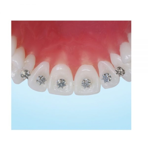 Tongue Tamers Plus 12 per pk 
