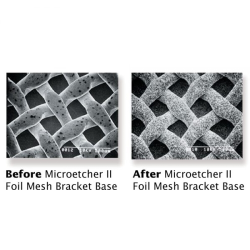 Microetcher II Kit