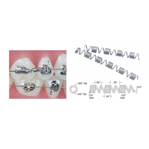 NiTi Distalizing Spring 10x45, 3/pk 