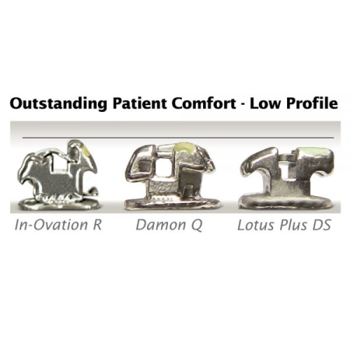 Mắc Cài Kim Loại Tự Buộc Lotus DS / Lotus Plus DS – Tối Ưu Hiệu Quả Chỉnh Nha Hiện Đại