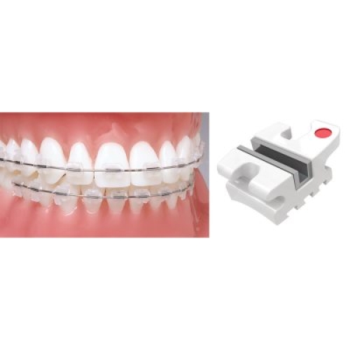 ENCORE® CERAMIC BRACKETS WITH METAL SLOT