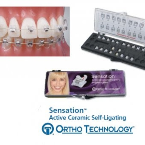 Sensation® Self-Ligating Ceramic Brackets – Ortho Technology (USA)