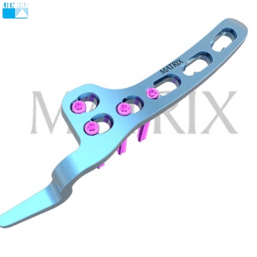Nẹp khóa móc khớp cùng đòn vít 3.5mm